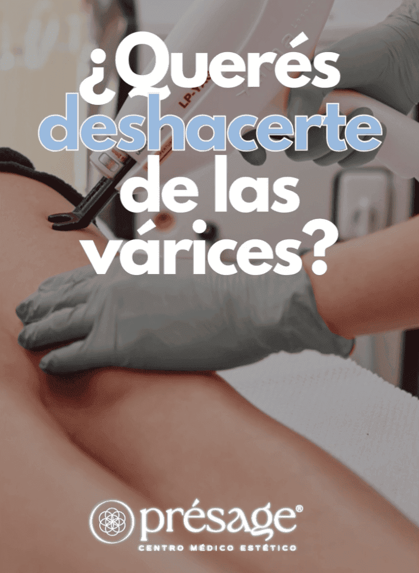 ¿Querés tratar las várices sin cirugía?